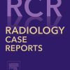 Radiology Case Reports: Volume 15 (Issue 1 to Issue 12) 2020 PDF