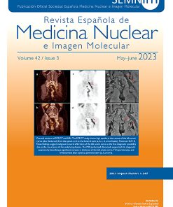 Revista Española de Medicina Nuclear e Imagen Molecular (English Edition): Volume 42 (Issue 1 to Issue 6) 2023 PDF