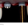 gIDE A to Z in Implant Dentistry (Course)
