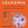 Acute Leukemia: An Illustrated Guide to Diagnosis and Treatment (PDF Book)