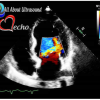 Adult Echocardiography – Test & Learn Registry Review Quiz – AllAboutUltrasound (HTML)