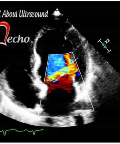 Adult Echocardiography – Test & Learn Registry Review Quiz – AllAboutUltrasound (HTML)