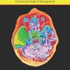 Arachnoid Cysts: Clinical and Surgical Management (PDF)