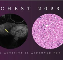 Chest Imaging (Course 2023) CME science course