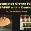 Concentrated Growth Factors: CGF/PRF within Dentistry (Video) (Course)