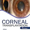 Corneal Transplantation, 3rd edition (PDF)