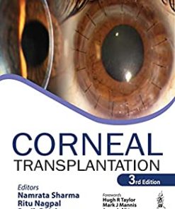 Corneal Transplantation, 3rd edition (PDF Book)