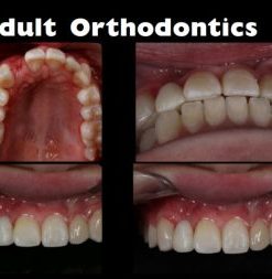 DentalXP Adult Orthodontics (Course)