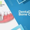 DentalXP Bone Grafts (Course)