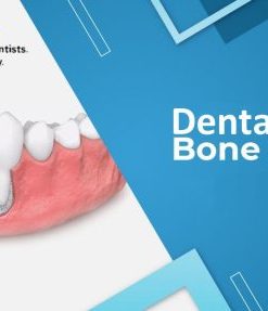 DentalXP Bone Grafts (Course)