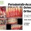 DentalXP Periodontally-Accelerated Osteogenic Orthodontics / Colin Richman (Course)
