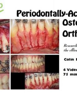 DentalXP Periodontally-Accelerated Osteogenic Orthodontics / Colin Richman (Course)