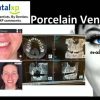 DentalXP Porcelain Veneers (Course)