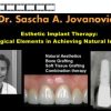 Esthetic Implant Therapy: Biological Elements in Achieving Natural Implants (Course)