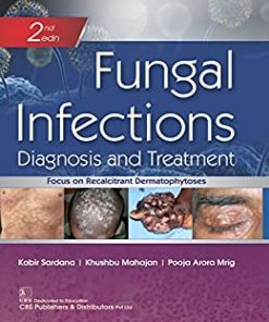 Fungal Infections Diagnosis and Treatment, 2nd edition (PDF Book)