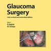 Glaucoma Surgery (Developments in Ophthalmology, Vol. 59) (PDF)