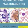 Handbook of Hematologic Malignancies (EPUB)
