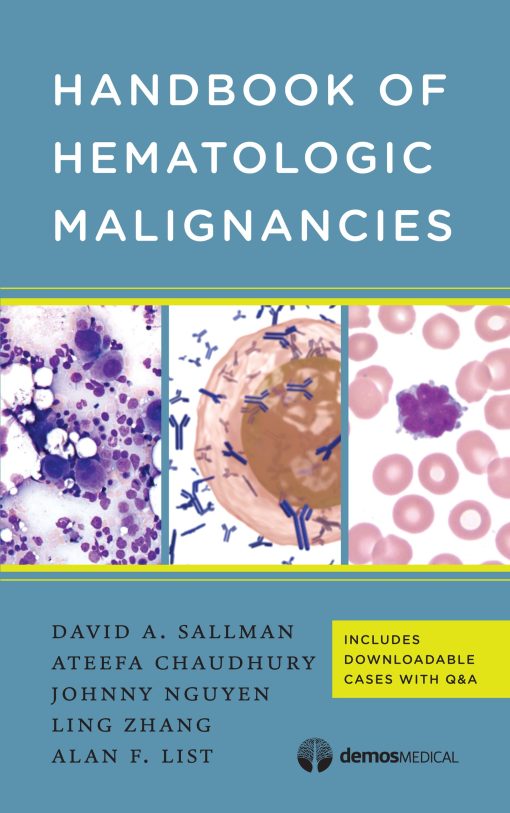 Handbook of Hematologic Malignancies (EPUB)