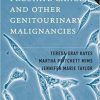 Handbook of Prostate Cancer and Other Genitourinary Malignancies (PDF)
