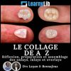 LearnyLib Le Collage de A – Z – Layan, Bonnafous Reflexion, Preparation et Assemblage des onlays, inlays et overlays (Francais) (Course)