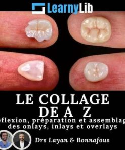 LearnyLib Le Collage de A – Z – Layan, Bonnafous Reflexion, Preparation et Assemblage des onlays, inlays et overlays (Francais) (Course)