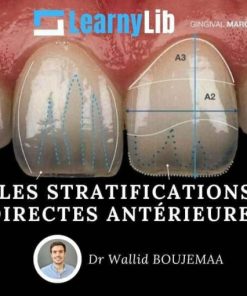 LearnyLib Les Stratifications Directes Anterieures – Ahmed Rabiey – Wallid Boujemaa (Course)