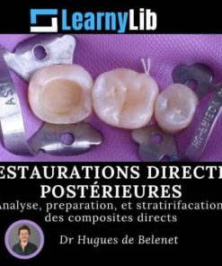 LearnyLib Restaurations Directes Postérieures – Hugues de Belenet Analyse, Preperetion, et Stratirifacation des Composites Directs (Francais) (Course)