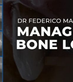 Managing Bone Loss (2 Lectures) Dr. Federico Mandelli (Course)