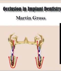 Occlusion in Implant Dentistry – Martin Gross (Course)