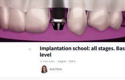 OHI-S Implantation School: All Stages, Basic and Intermediate Level – Ana Ferro (Course)