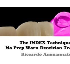 OHI-S The INDEX Technique, No Prep Worn Dentition Treatment – Ricardo Ammannato (Course)