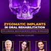 OHI-S Zygomatic Implants in Oral Rehabilitation (Course)