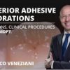 Osteocom Posterior Adhesive Restorations: Indications, Clinical Procedures and mDPT Techniques / Marco Veneziani (Course)