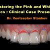 Restoring the Pink and White Esthetics: Clinical Case Presentation (Course)