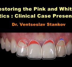 Restoring the Pink and White Esthetics: Clinical Case Presentation (Course)