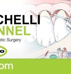 Zucchelli Channel, Soft Tissue Esthetic Surgery – Giovanni Zucchelli (italiano) (Course)