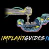 Implant Ninja .The Implant Guides 101 Course (Course)