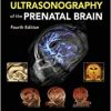 Timor’s Ultrasonography of the Prenatal Brain, 4th edition (PDF)
