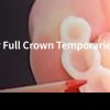 Classic Collection: Anterior Full Crown Temporaries
