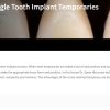 Classic Collection: Single Tooth Implant Temporaries