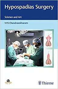Hypospadias Surgery: Science and Art (PDF)