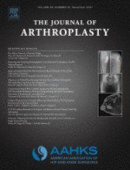 The Journal of Arthroplasty: Volume 36 (Issue 1 to Issue 12) 2021 PDF