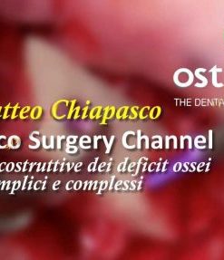 Chiapasco Surgery Channel – Matteo Chiapasco Tecniche ricostruttive dei deficit ossei semplici e complessi (Course)