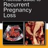 Practical Guide to Recurrent Pregnancy Loss (PDF)