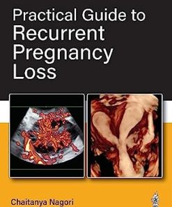 Practical Guide to Recurrent Pregnancy Loss (PDF)
