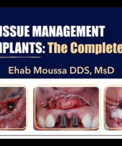 Soft Tissue Management for Implants, The Complete Course – Ehab Moussa (Course)