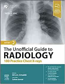 The Unofficial Guide to Radiology: 100 Practice Chest X-rays, 2nd edition (EPUB)