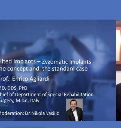Tilted and Zygomatic Implants – Enrico Agliardi Lectures List (Course)
