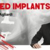 Tilted Implants – Enrico Agliardi (Italiano) (Course)