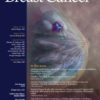 Clinical Breast Cancer: Volume 22 (Issue 1 to Issue 8) 2022 PDF